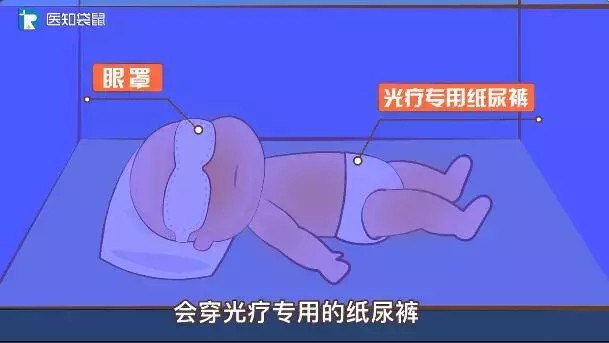 宝宝黄疸值多高要住院？在家怎么退黄快？