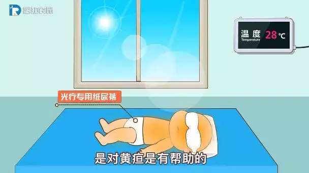 宝宝黄疸值多高要住院？在家怎么退黄快？
