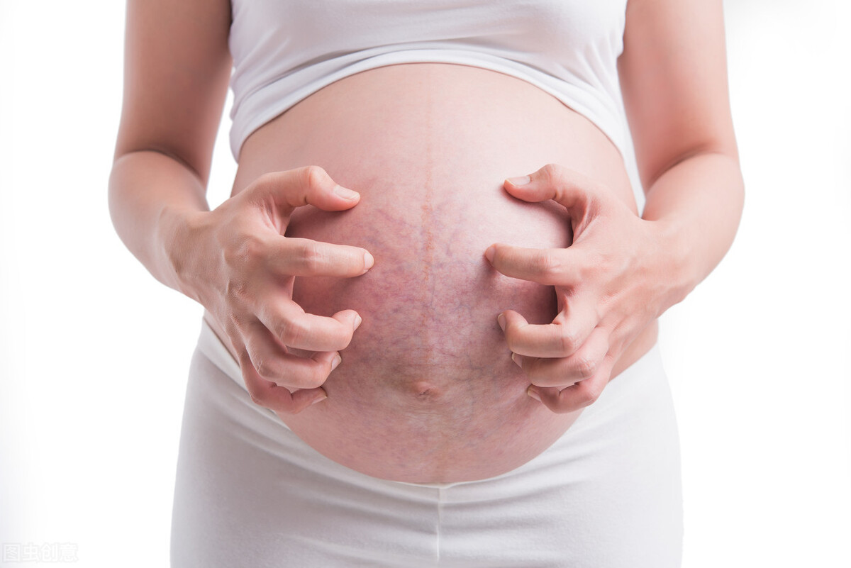 孕期皮肤瘙痒怎么回事？孕妇瘙痒难耐如何是好？