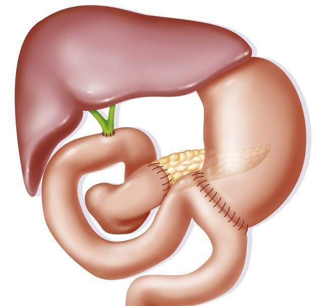 胰腺在左边还是右边，胰腺位于身体哪个部位？