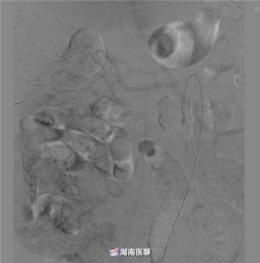 同样是“腹痛”，原因各不同！5类表现带你发现要命的“肚子疼”