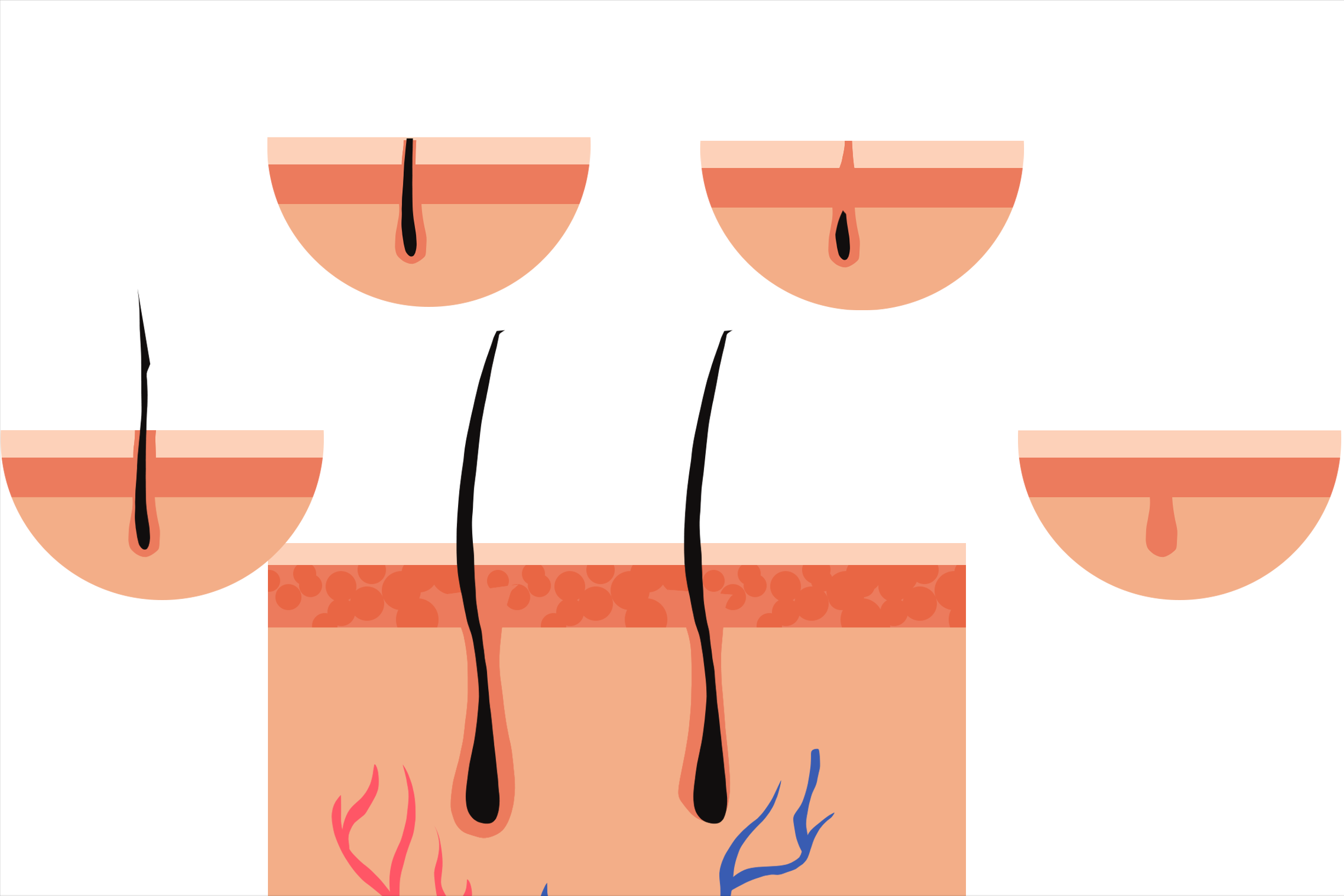 私处毛发有用别乱刮！但3种情况，剃了会更好