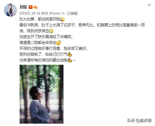 喜多嫂：奥运冠军刘璇二胎得女，孕期长满红疹，皮肤发痒怎么办？