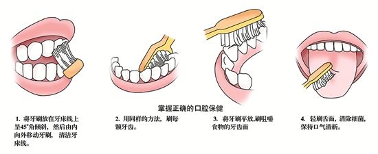 牙龈萎缩非小事，拖久不治危害大，初期不治晚期花费上万都难恢复
