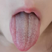 宝宝咳嗽，爸爸妈妈寝食难安？2个真实案例，小儿咳嗽注意啥
