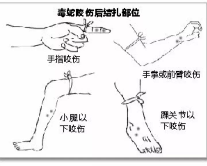 印度男子与蛇互咬被毒死！咬人的青环蛇有多毒，被咬该如何自救？