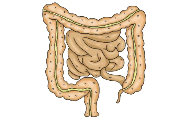 频繁放屁是身体在排毒？屁多的真正原因，了解一下