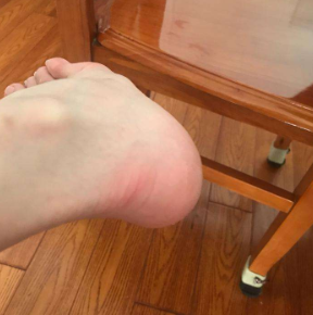 医生：脚后跟会疼？原因无非这4种之一！摸清楚，对症解决并不难