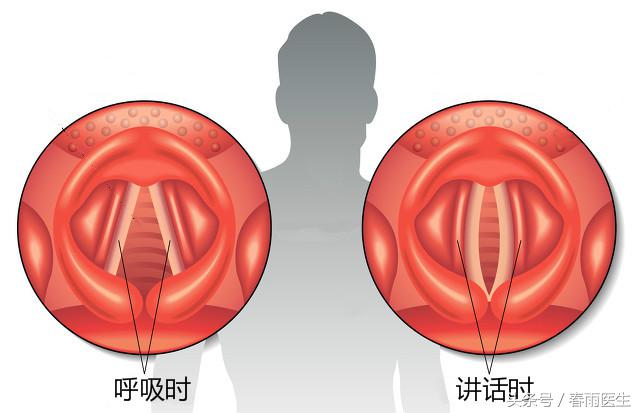 KTV嗨到喉咙沙哑，“破了”的嗓子要怎么办才好？