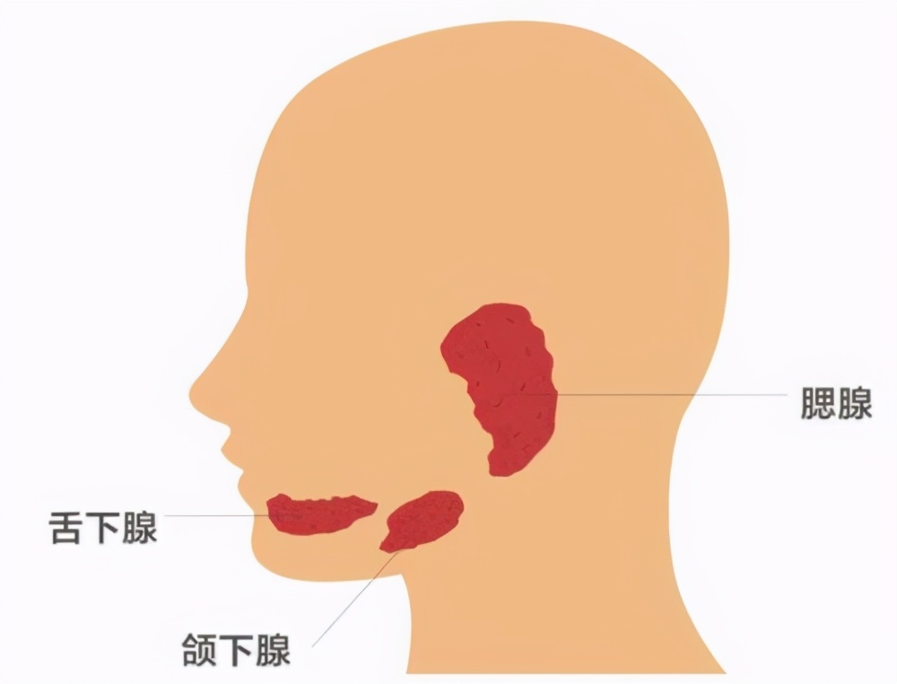 耳前黄豆大的小疙瘩，别不上心，可能是腮腺肿瘤