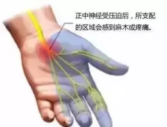 手指发麻预示着10种疾病，你还敢再大意？