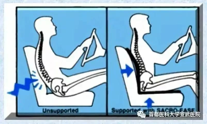 腰痛腿麻怎么办？是椎间盘突出了吗？
