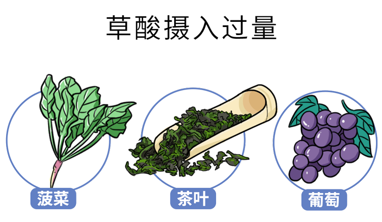 很多结石都是“吃”出来的！这些不良饮食习惯，你中招了吗？