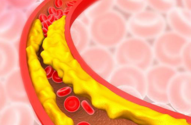 中国男人再上健康“黑榜”：「胆固醇」涨幅位列全球前十