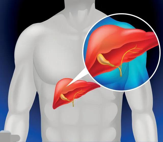 肝功能单纯胆红素升高，吃了很多药都没有效果？医生给你分析病因