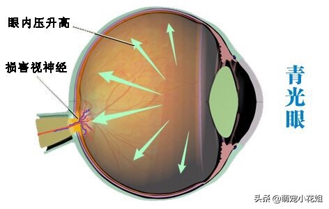 犬青光眼致盲率最高的眼科病，该如何治疗？最终都会失明吗？