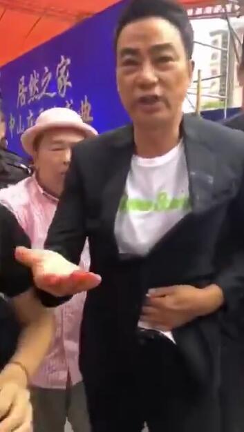 3厘米的刀伤，4根手指划伤，任达华伤势该如何处理？