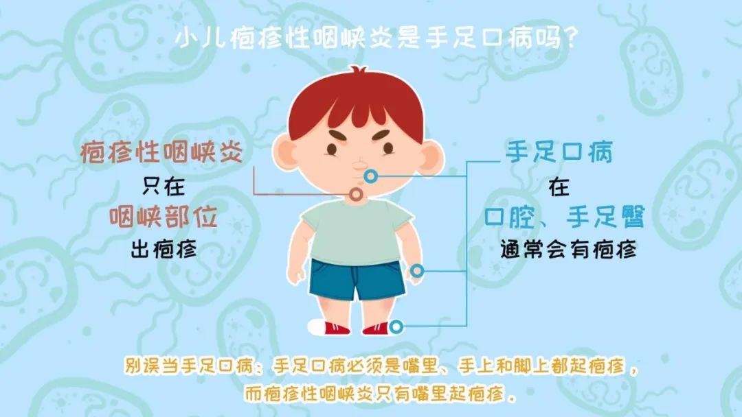什么是疱疹性咽峡炎？如何预防小儿疱疹性咽颊炎