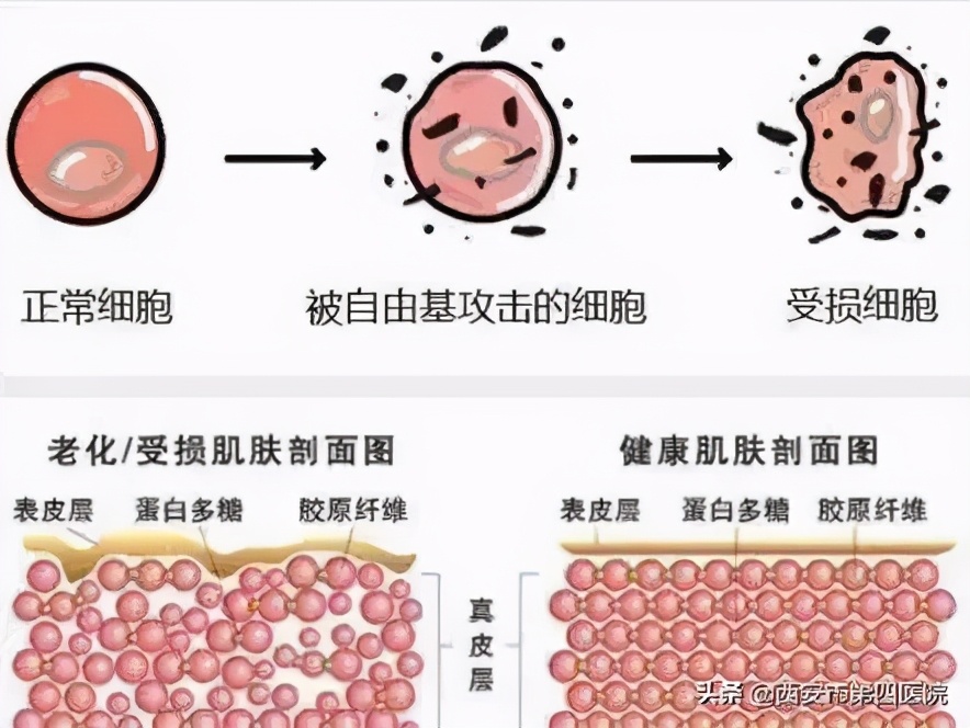 #健康中国行动2030#【变美秘籍】毛孔粗大怎么彻底解决？