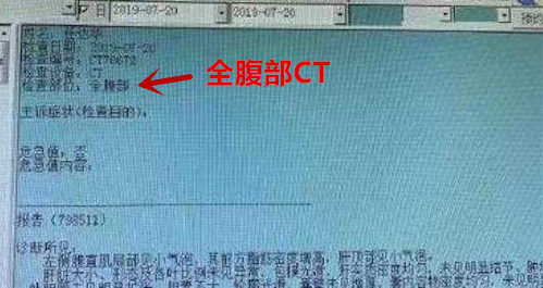 3厘米的刀伤，4根手指划伤，任达华伤势该如何处理？