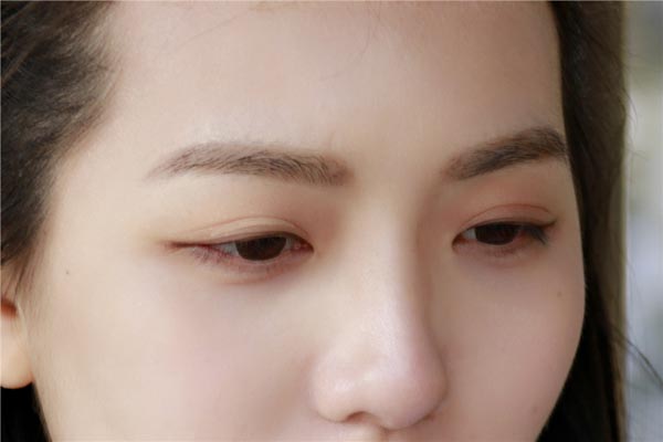 眼睛白眼球发黄怎么办，如何保护眼睛