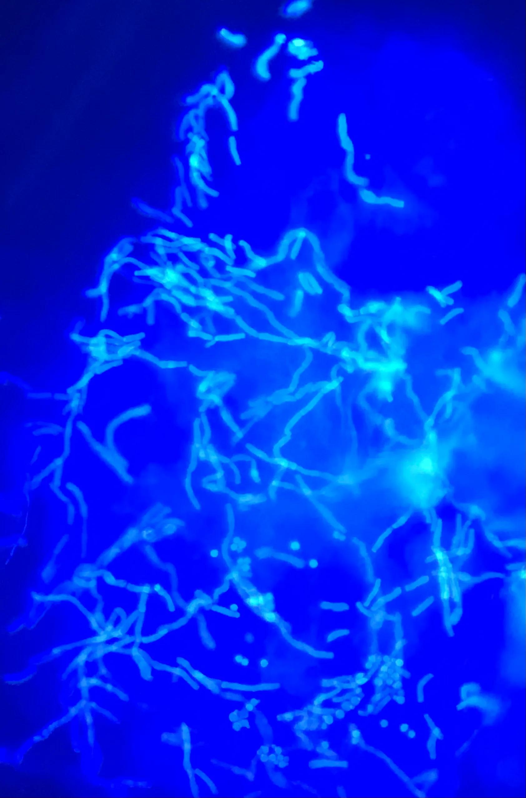 医生教你怎么治理香港脚（脚气、足癣）