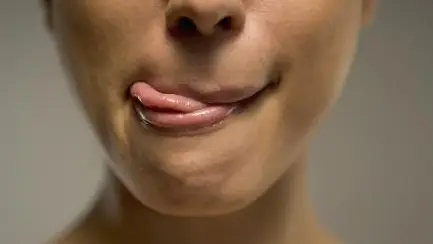 嘴角烂了怎么快速好（嘴角烂是上火的表现吗）