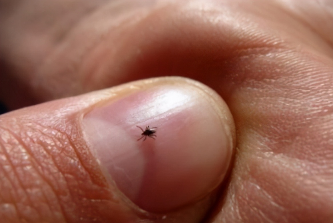 蜱虫可致命,为何生活中到处都是,人们不怕被附体夺命?