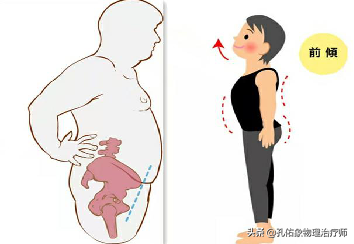 腰椎间盘突出压迫神经了，屁股和腿疼，有什么好的治疗方法？