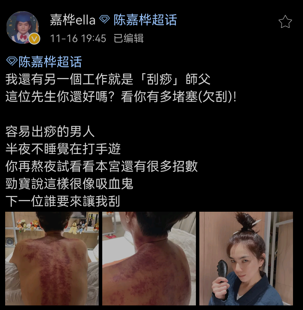 Ella为丈夫刮痧，对镜自拍表情俏皮，结婚多年被宠成少女