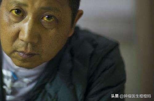 腹痛腹胀食欲差，检查发现竟是癌症晚期，医生：这样做可早诊早治