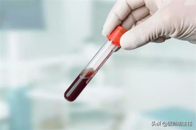 高血压：同型半胱氨酸高，你以为吃叶酸就行了？再查查血清叶酸吧