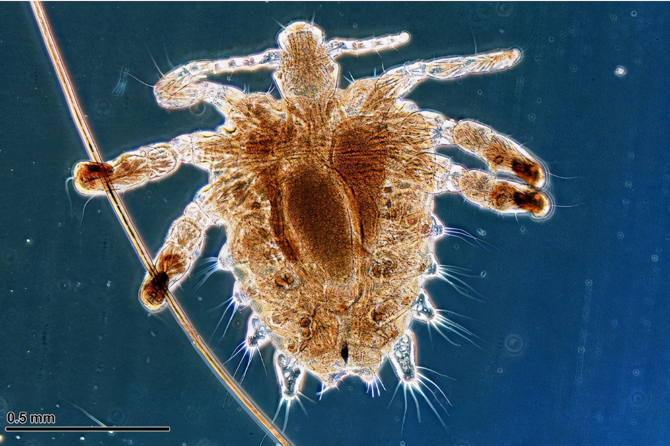 根据形态,寄生部位以及习性等差异,虱子可以细分为头虱,体虱和阴虱.