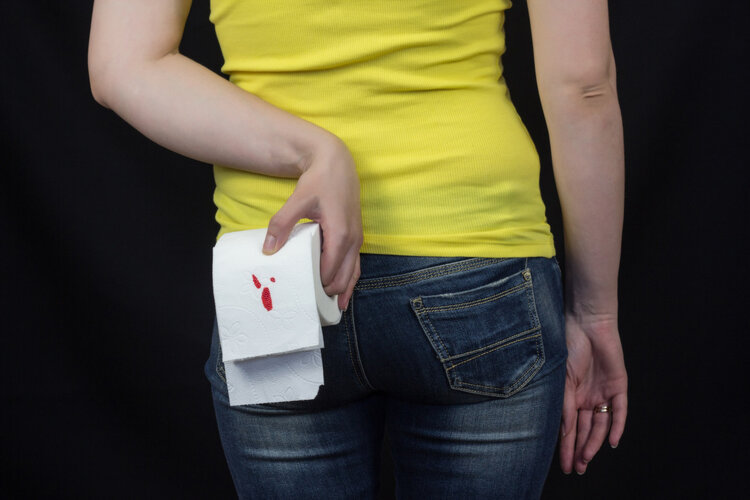 肛门经常潮湿、瘙痒，怎样好得快？别不好意思，4个办法来帮你