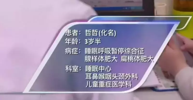 OSAHS被忽视的睡眠“杀手”，宝宝鼻炎、中耳炎、变丑都跟TA有关
