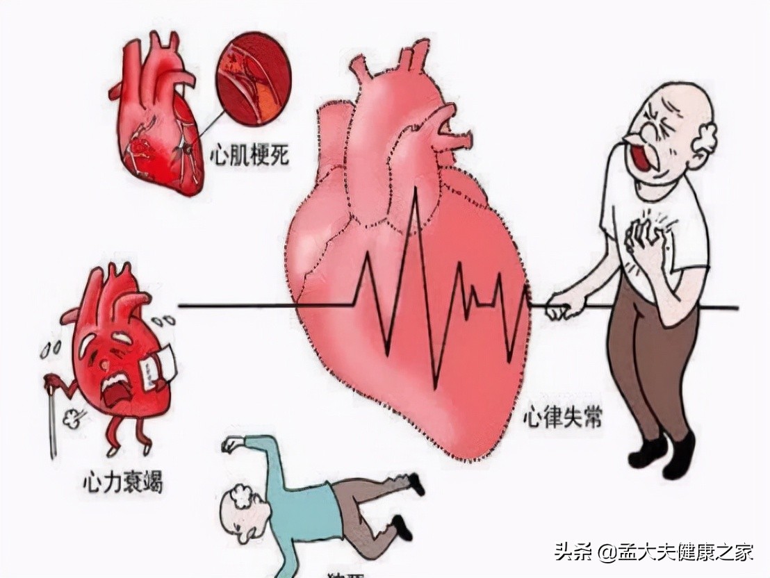 冠心病,心绞痛根在血脉不通,2个成药理气活血化瘀,保护心血管