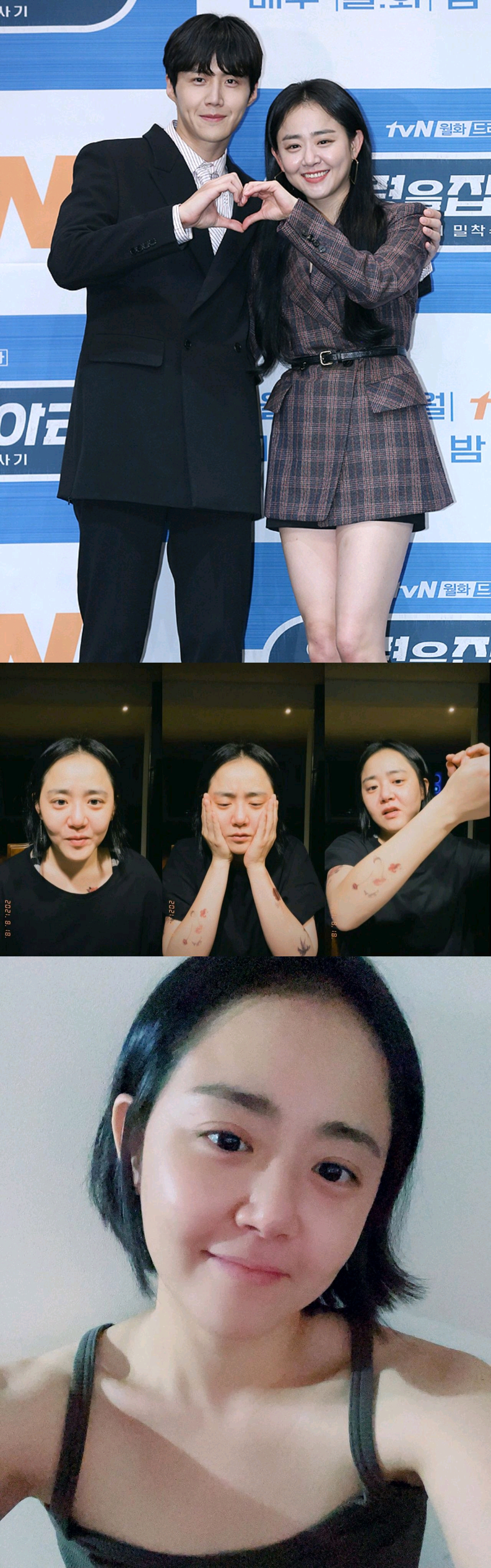 《蓝色生死恋》文根英直播,生病差点截肢的韩国国民妹妹也34岁了