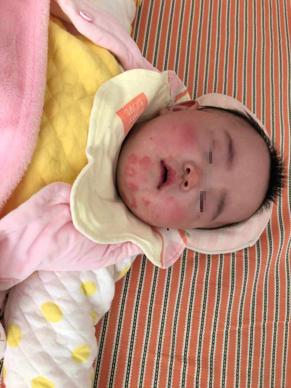 氨基酸奶粉、深度水解奶粉和适度水解奶粉，今天一次性讲清楚