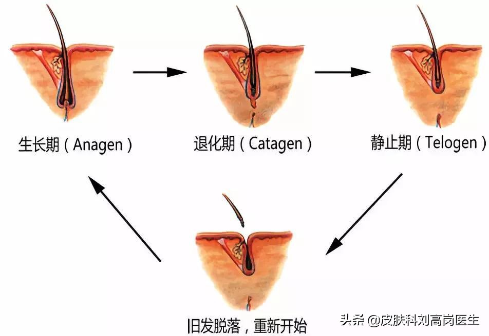 常见11种皮肤病讲解之「目前治疗脂溢性脱发最有效的三种方法」