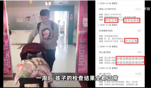 “大头宝宝”再现，疑似激素导致！如何避免“被迫性”激素滥用？