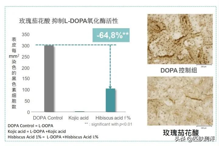 不止是水乳!拯救黑头的宅家刷指南—花皙蔻洛神花精华套装测评