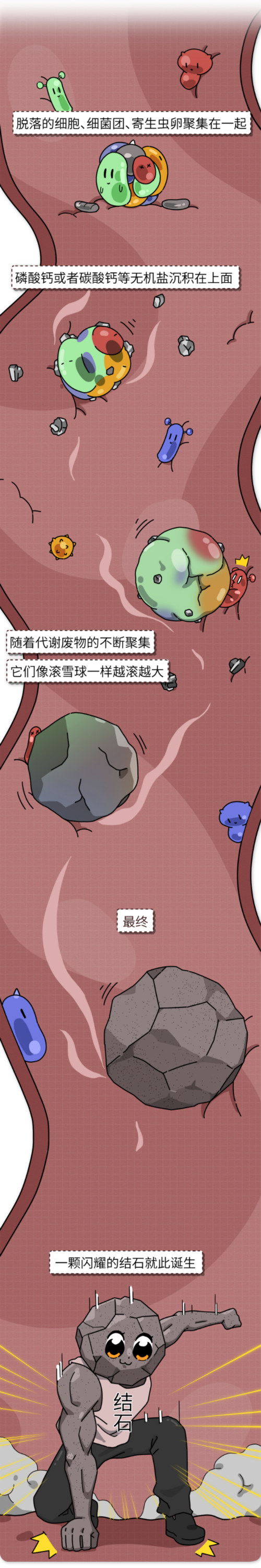 很多结石都是“吃”出来的！这些不良饮食习惯，你中招了吗？