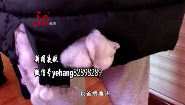 又是恶犬伤人！大年里，75岁老人就这么走了…