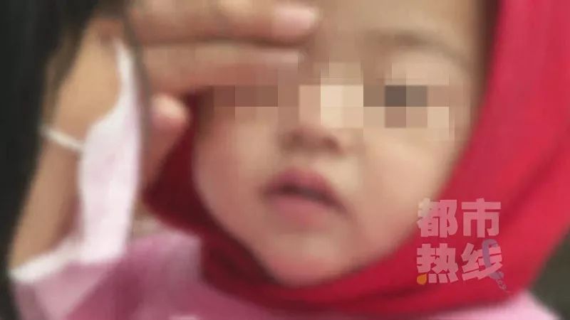 西安女子被自家狗扑咬重伤 皮肤撕脱、多处骨折 诊断为狂犬病Ⅲ级暴露