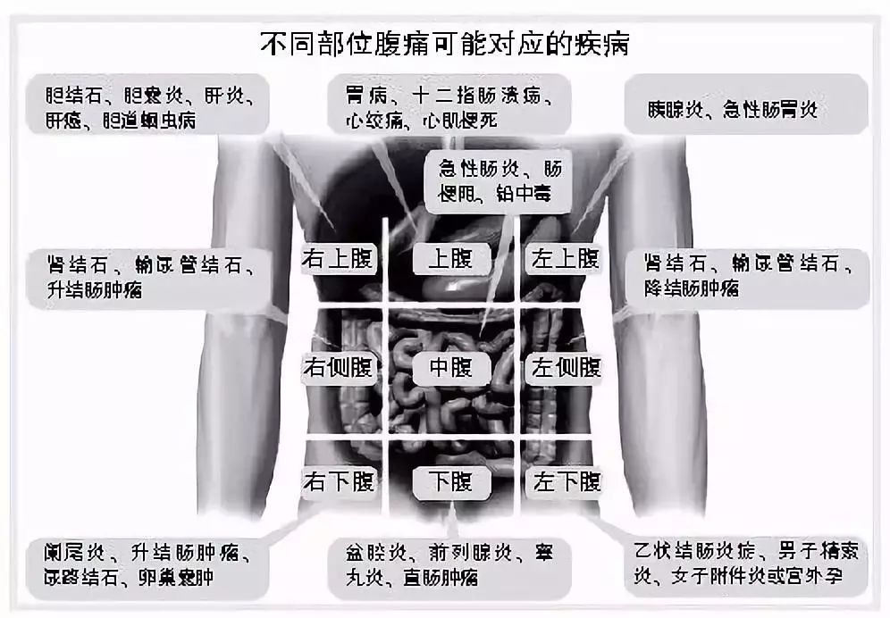 肚脐周围疼痛可能是什么原因引起的？