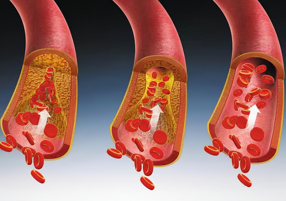 午睡虽好，并不是人人都适合，以下3类人尽量不要午睡，没开玩笑