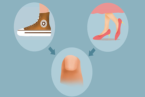 脚指甲长到肉里面，一走路就疼？自己在家如何应对？