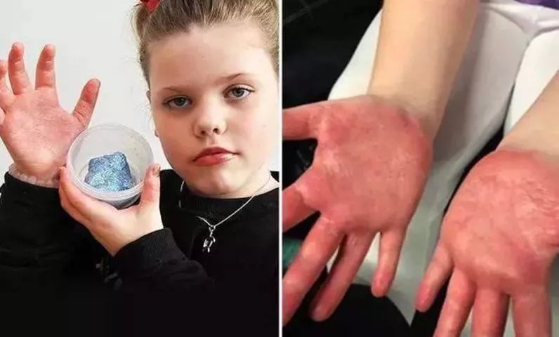 2克可致死！央视再点名，这种玩具含剧毒，孩子很爱玩！快扔掉