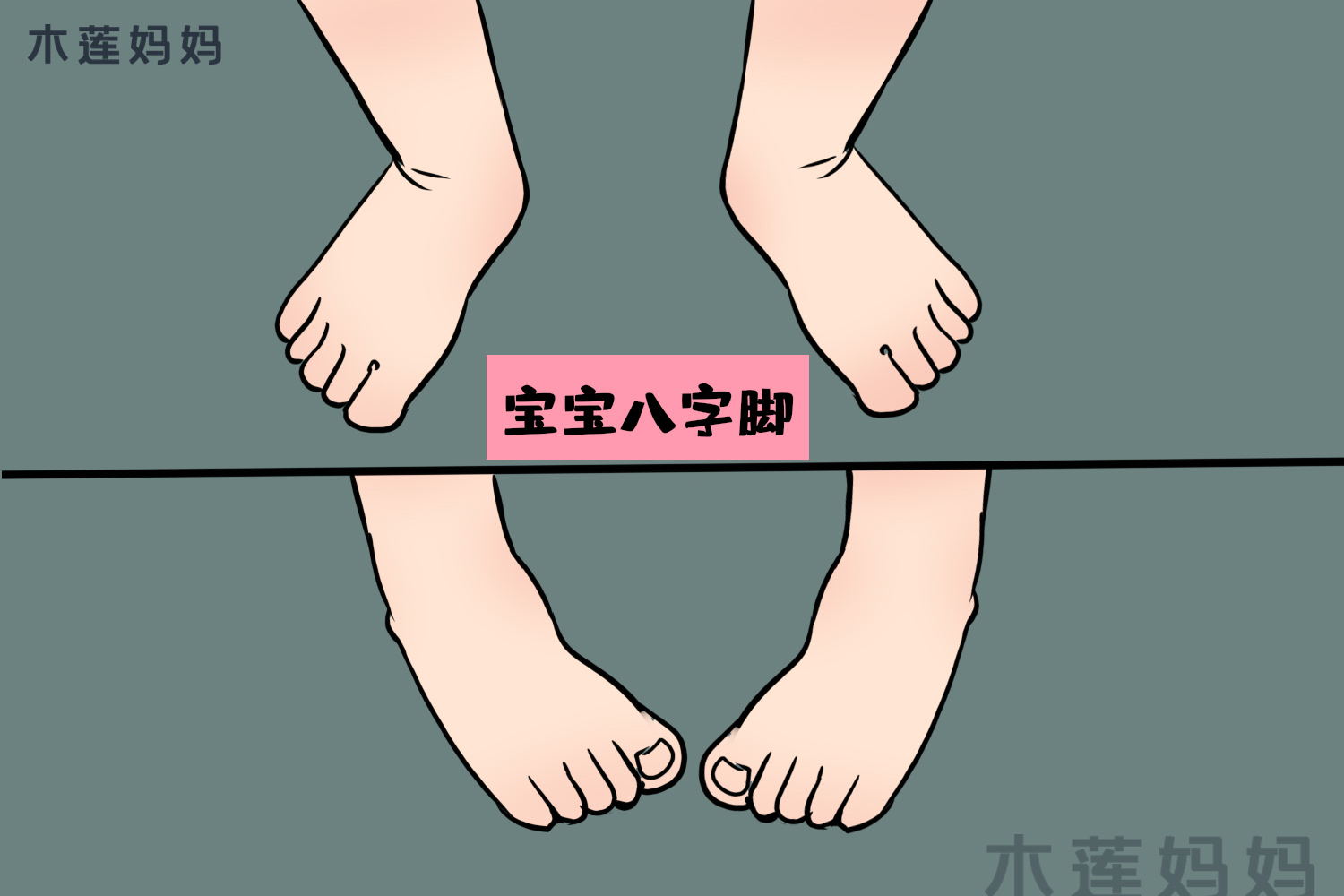 不仅仅走路姿势不是很雅观,重要的是对运动也带来不变,鞋子磨损程度也