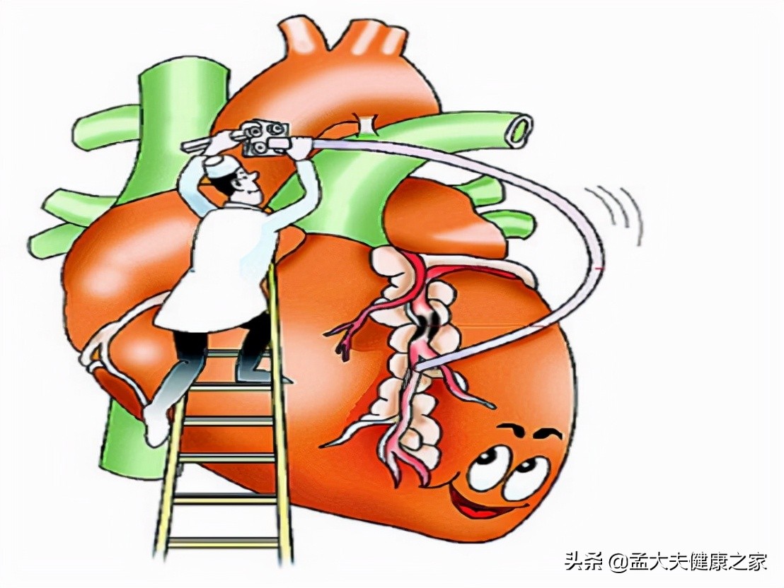 冠心病、心绞痛根在血脉不通，2个成药理气活血化瘀，保护心血管